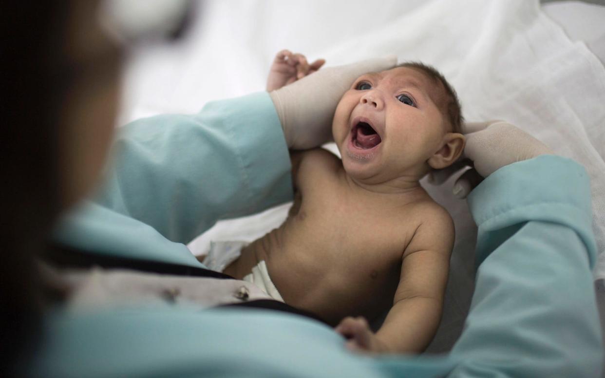 Thousands of children were born with a rare condition, microcephaly, linked to the Zika virus - Felipe Dana/AP