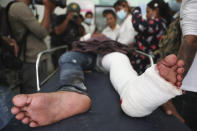 An injured protester receives medical treatment during a demonstration against the military coup in Mandalay, Myanmar, Friday, Feb. 26, 2021. (AP Photo)