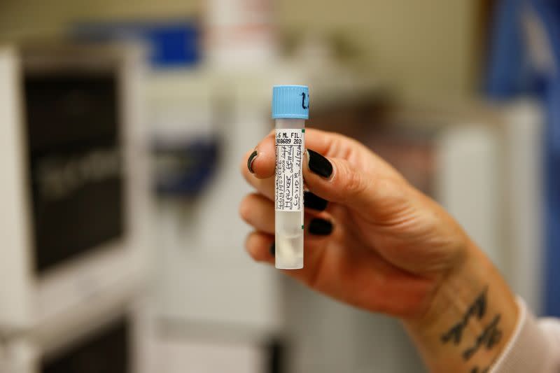 A medical worker tests swabs for the novel coronavirus at the Microbiology department of North Devon District Hospital in Barnstaple