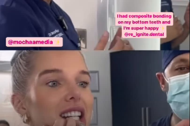 Helen shared videos of the process on social media -Credit:Helen Flanagan Instagram