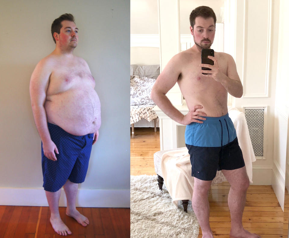 “Since losing almost all of my excessive weight, I feel fantastic.” (Photos: Courtesy of Dr. Kevin Gendreau)