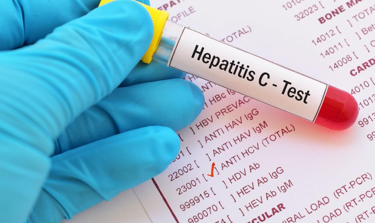 If left untreated, hepatitis C can cause liver damage, liver cancer, bleeding and even death.