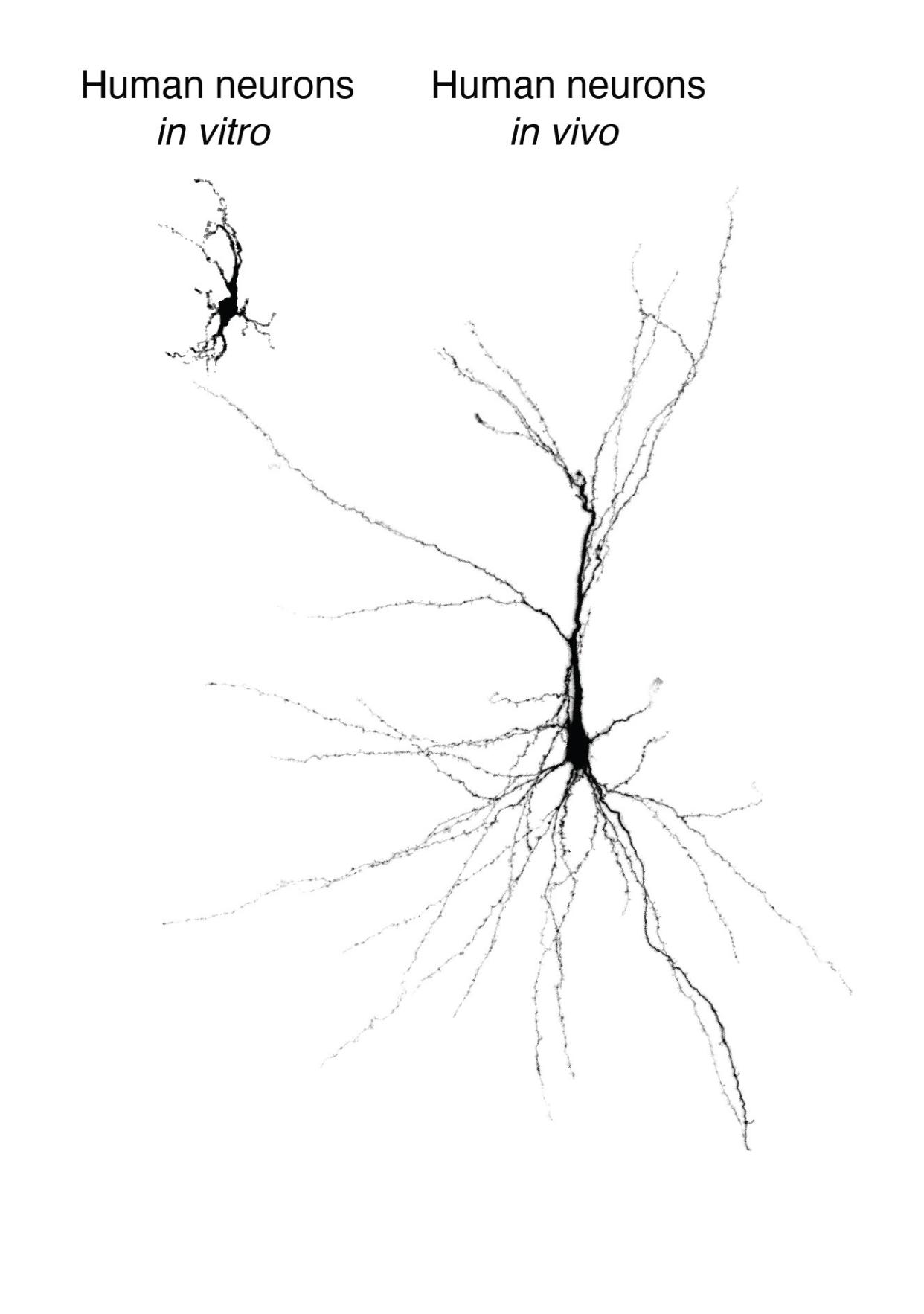 Human neurons