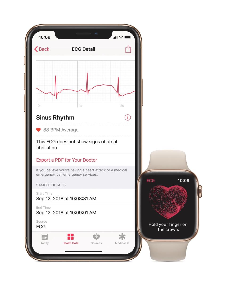 After the Apple Watch ECG feature delivers a result, you'll see a waveform you can share with your doctor.