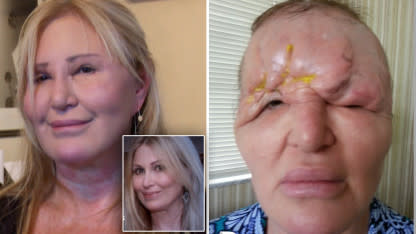 Woman: Fix-A-Flat 'doctor' disfigured my face – Orange County Register