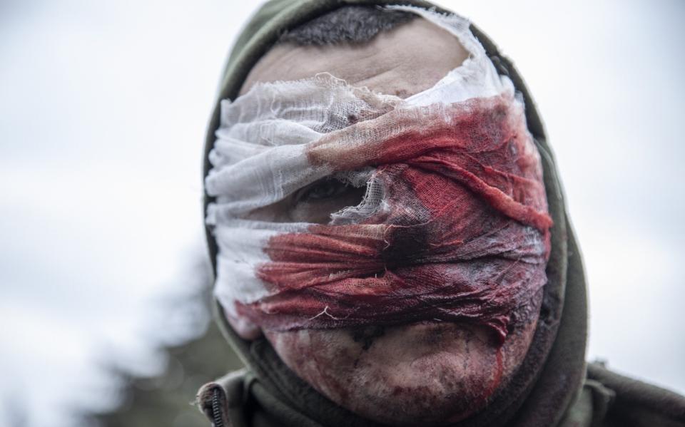 A Ukrainian serviceman arrives severely wounded to the evacuation point after being removed from the Avdiivka battlefield