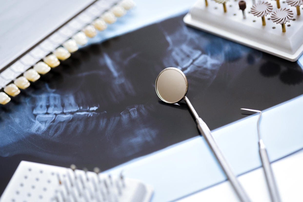 Dentist x-ray with teeth specimens. (Getty Images file photo)