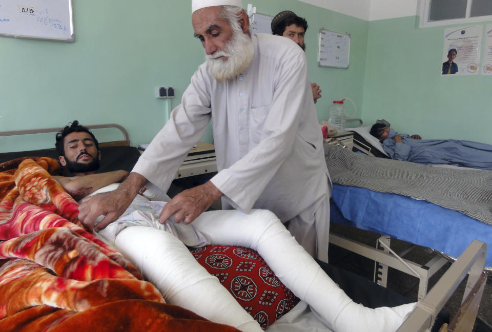 Wounded Afghans lie on a bed at a hospital after fighting between Taliban and Afghan security forces in Kandahar province south of Kabul, Afghanistan, Thursday, Aug. 5, 2021. (AP Photo/Sidiqullah Khan)