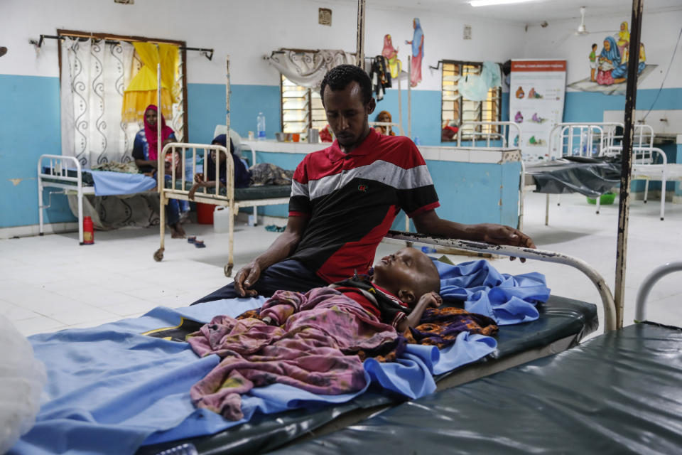 Ali Alkadir Hassan sits with his malnourished son Khalid Ali Alkadir, 5, in the International Rescue Committee (IRC) hospital at Dadaab refugee camp in northern Kenya Wednesday, July 12, 2023. One of the world's largest refugee camps offers a stark example of the global food security crisis with thousands of people fleeing Somalia in recent months to escape drought and extremism but finding little to eat when they arrive at the Dadaab camp in neighboring Kenya. (AP Photo/Brian Inganga)