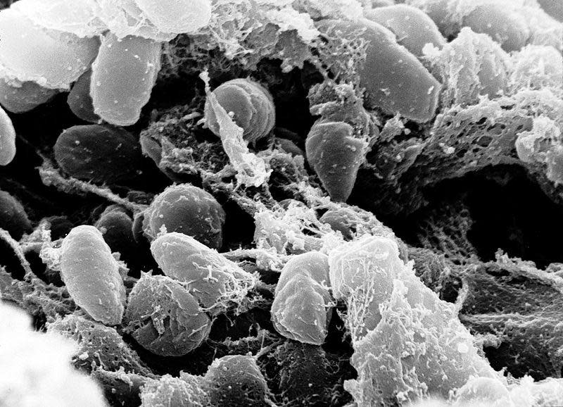 Fleas transmit plague bacteria to humans (Rocky Mountain Laboratories)