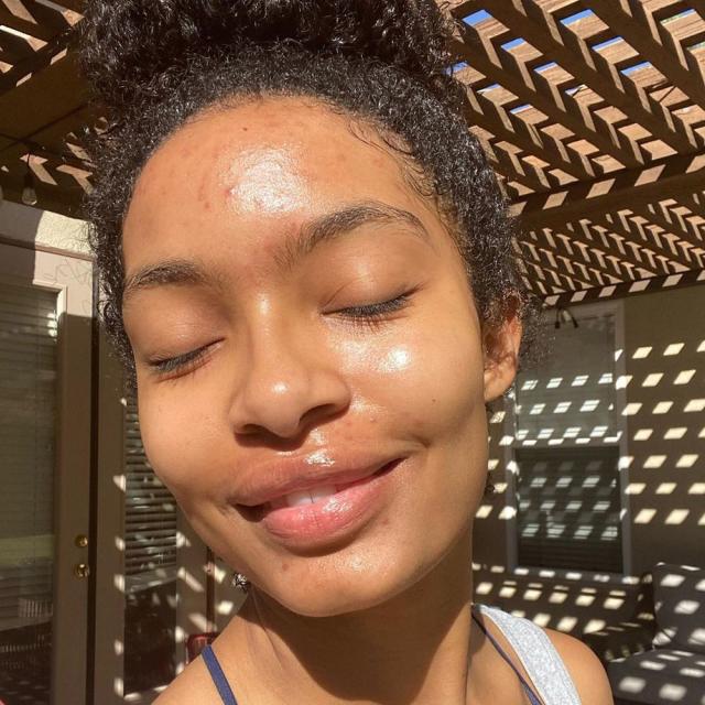 Yara Shahidi Shares Makeup Free Selfie