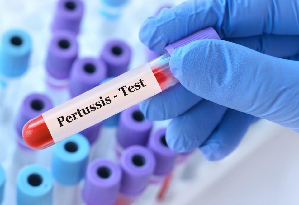 Pertussis test