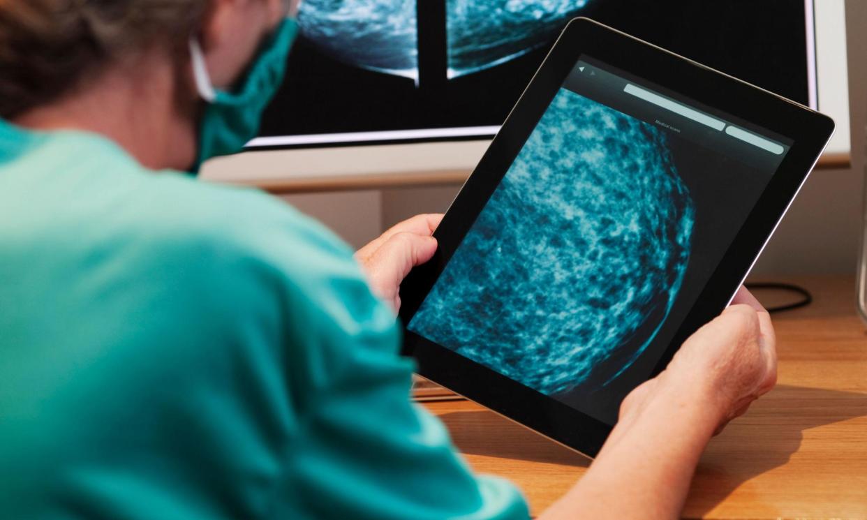 <span>A clinician examining a mammogram. Early detection of cancer is vital to improving survival rates.</span><span>Photograph: Malcolm Park sciences/Alamy</span>