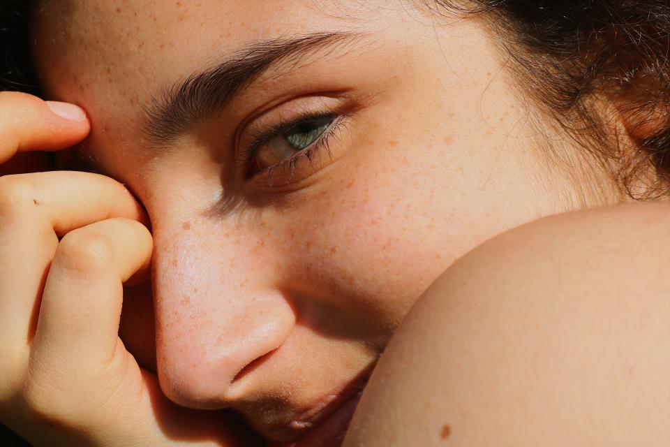 El freckling es la tendencia de diseñar pecas en el rostro de forma artificial y busca brindar un aspecto más fresco y aniñado. (Getty Creative)