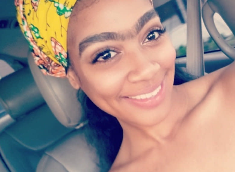 A woman who was called a ‘wolf’ and ‘Golden Arches’ by school bullies because of her monobrow says she now embraces it and is more confident than ever. Photo: MEGA