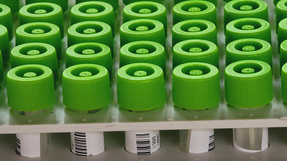 Vials of self-administered COVID-19 PCR tests sit in a rack at the Lincoln Park Recreation Center in Los Angeles on Thursday, Dec. 30, 2021. More than a year after the vaccine was rolled out, new cases of COVID-19 in the U.S. have soared to their highest level on record at over 265,000 per day on average, a surge driven largely by the highly contagious omicron variant. (AP Photo/Damian Dovarganes)