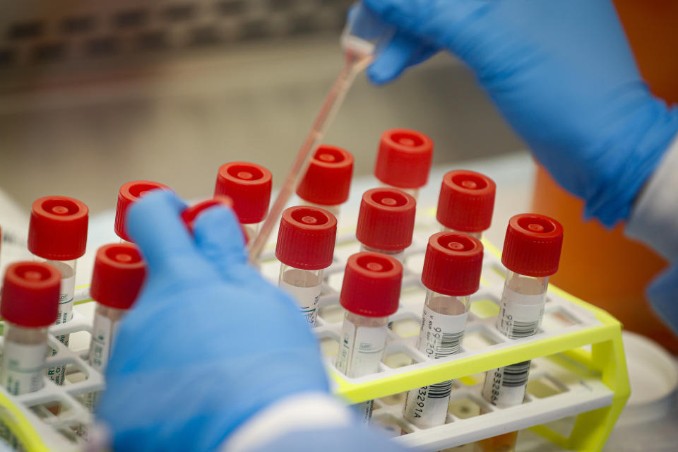 A laboratory technician prepares COVID-19 patient samples