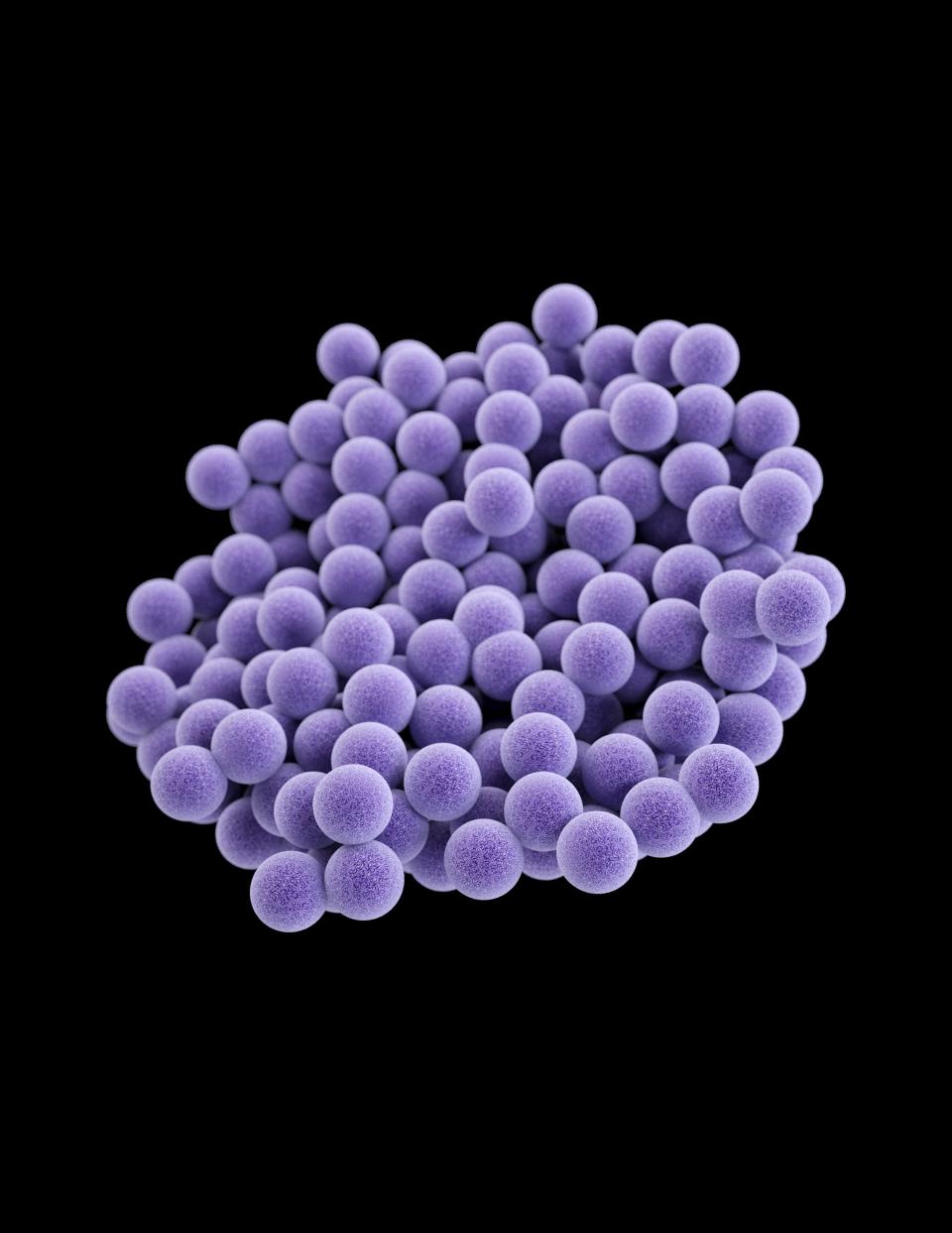 A cluster of methicillin-resistant Staphylococcus aureus (MRSA) bacteria. MRSA can cause skin infections, blood stream infections and pneumonia. For Kim Painter's story on the World Health Organization sounding the alarm on rising levels of antibiotic resistance.