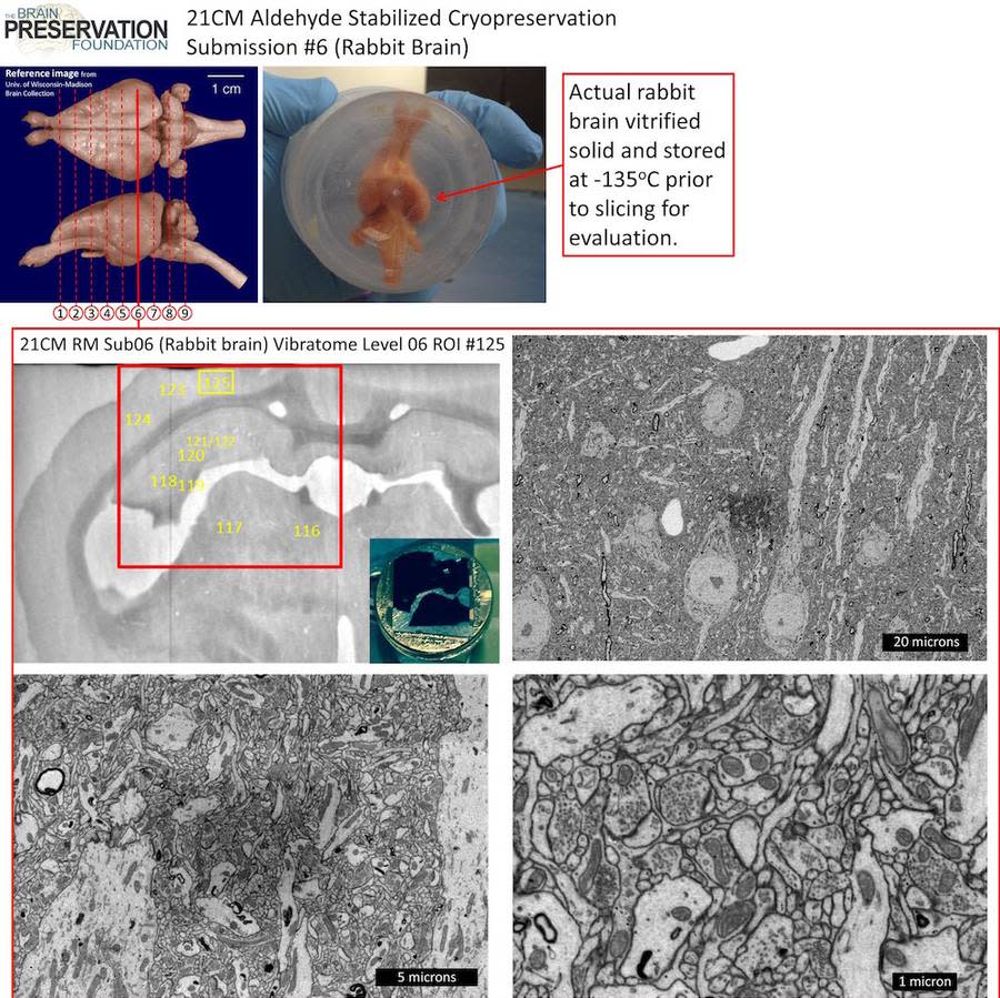 Scientists Have Successfully Preserved an Entire Rabbit Brain for the First Time Ever