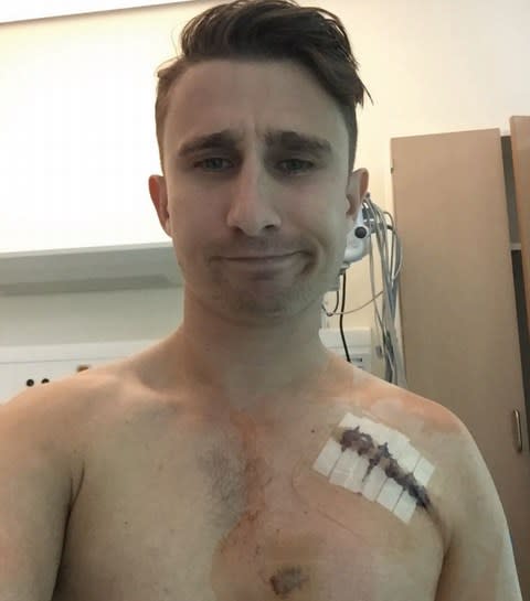 James Taylor shows off his scars after undergoing heart surgery - Credit: James Taylor: 'Cut Short'