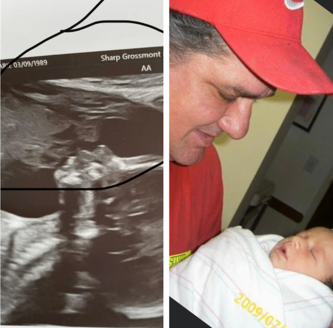 Pictured is the image of Ms Carillo's father holding her first child, born in 2009, next to the recent scanned image. Source: Reddit