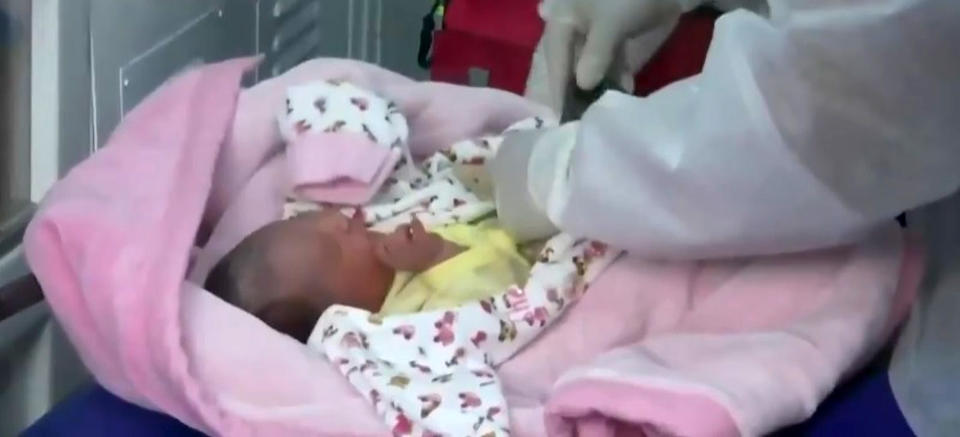 The baby being checked by the doctors. Source: RealPress/Australscope