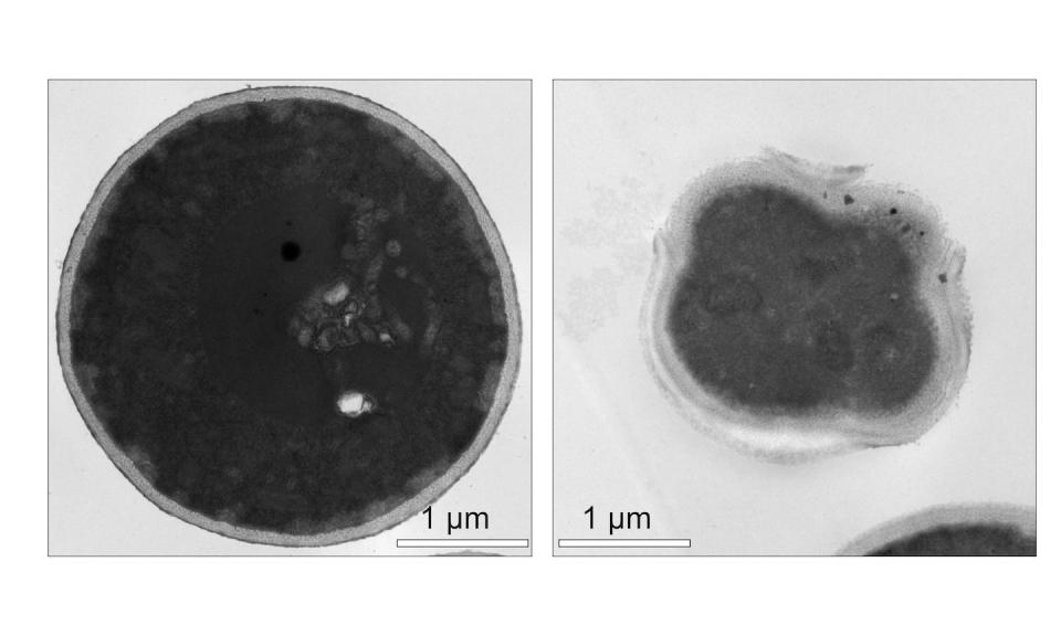 <em>Candida albicans</em> before and after being exposed to light-activated molecular machines. Molecular machines puncture <em>C. albicans</em>‘ cell wall and intracellular organelles, eventually killing the fungal cell. Matthew Meyer/Rice University.