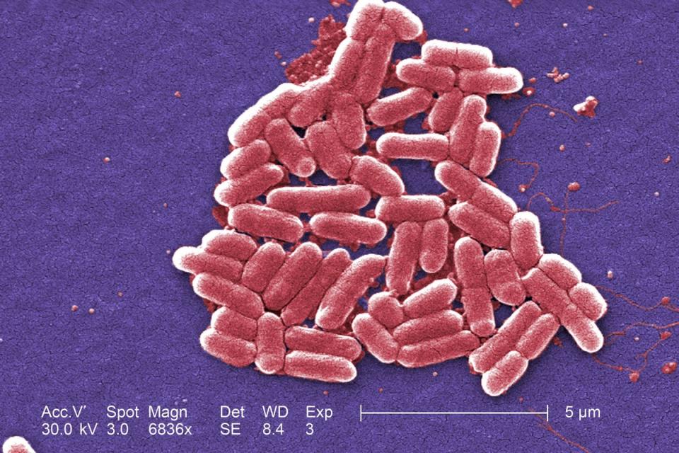 Health officials said on Thursday that a further 19 cases of E.coli had been reported in the UK (PA Media)