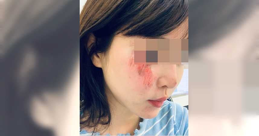 莊女指控自己遭司機爆打，臉頰更因此毀容。（圖／翻攝畫面）