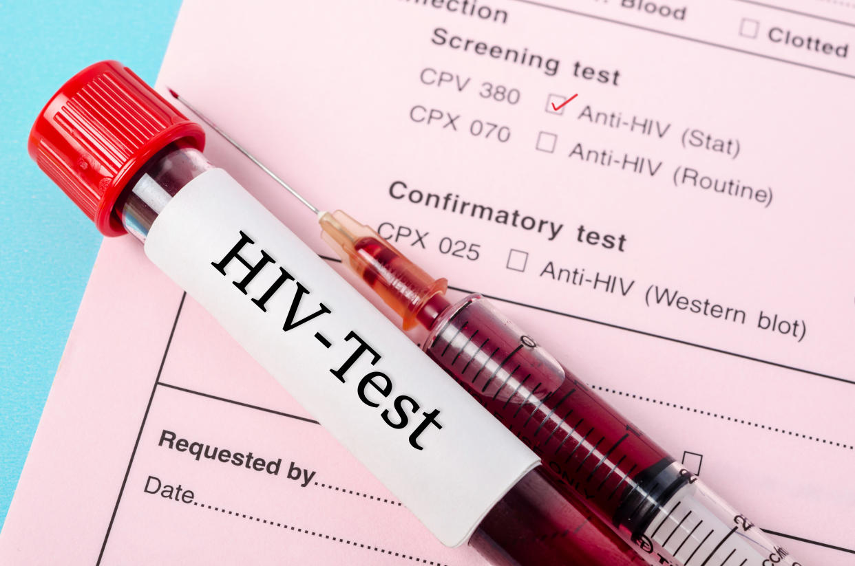 Sample blood collection tube with HIV test label on HIV infection screening test form.