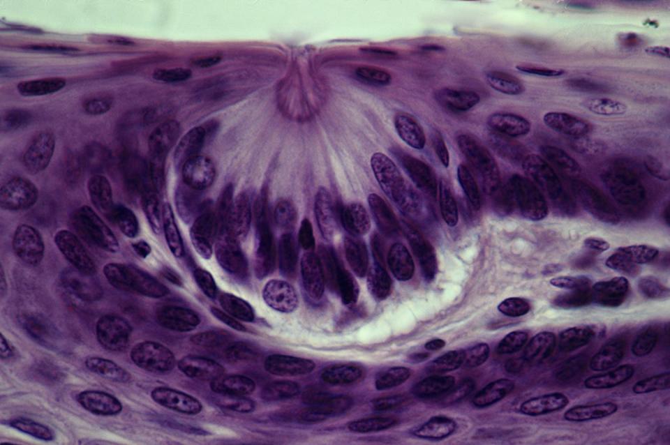 Microscopic cross section of the tongue’s surface. Taste buds are clusters of cells embedded beneath the tongue’s surface, facing into the mouth through a small pore (top). Here, the taste bud is the round cluster of cells at center. <a href="https://www.gettyimages.com/detail/photo/shows-a-single-taste-bud-with-a-taste-pore-facing-royalty-free-image/139826481" rel="nofollow noopener" target="_blank" data-ylk="slk:Ed Reschke/Stone via Getty Images;elm:context_link;itc:0;sec:content-canvas" class="link ">Ed Reschke/Stone via Getty Images</a>