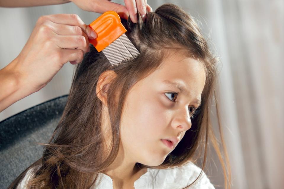 There has been an alarming uptick in lice throughout NYC and the suburbs, experts say. Getty Images/iStockphoto