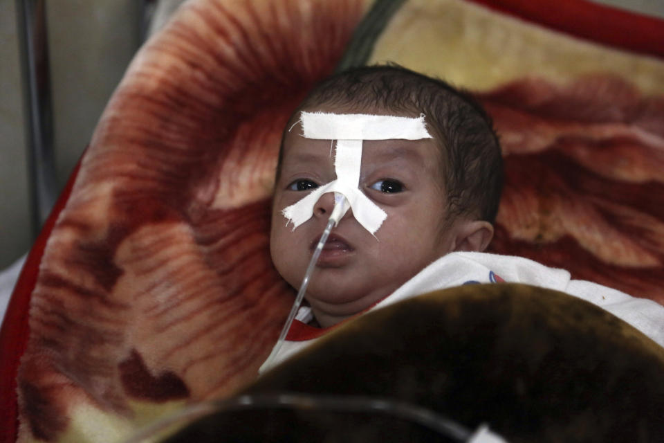 In this Oct. 15, 2019 photo, an Afghan child receives treatment for respiratory problems at a pediatric hospital, in Kabul, Afghanistan. Kabul, a city of some 6 million, has become one of the most polluted cities in the world, as decades of war have wrecked infrastructure and caused waves of displaced people. Authorities are trying to tackle pollution in the country’s capital, which may be even deadlier than 18-year-old war. (AP Photo/Rahmat Gul)