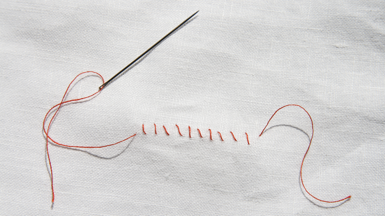 What is the husband stitch? (Photo: Getty Images)