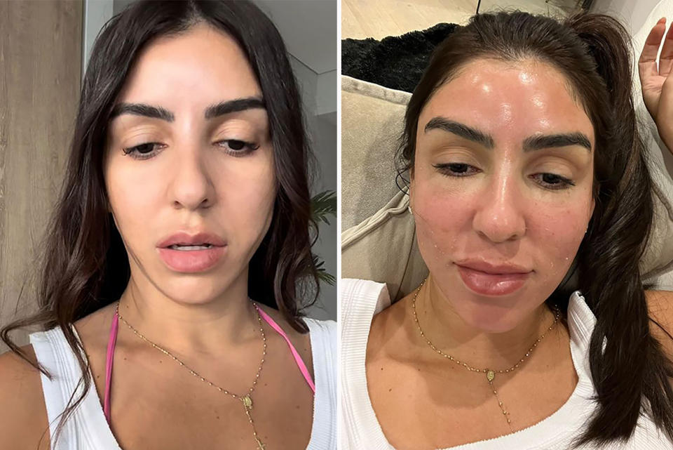 Former MAFS star Carolina Santos shows her face after beauty treatments