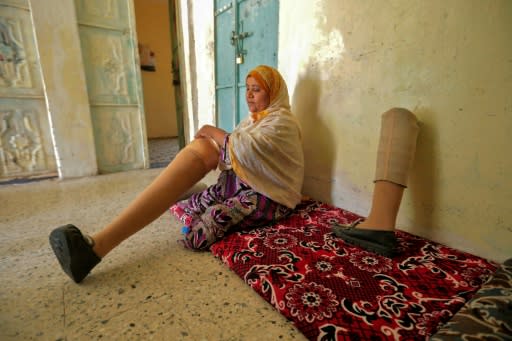 Jamila Qassem Mahyoub, a Yemeni woman whose legs were amputated after stepping on a landmine while herding her sheep in 2017, holds a prosthetic leg in a house in Yemen's third city of Taez in March 2019