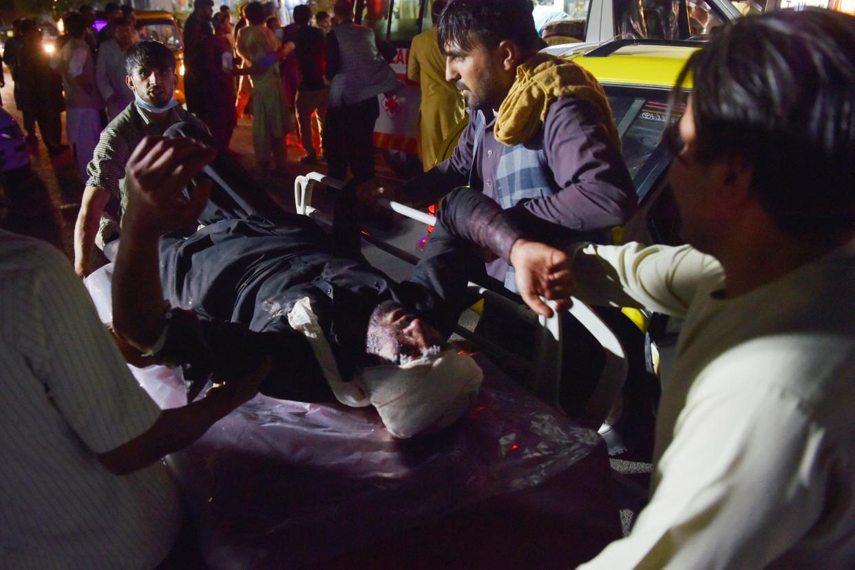 TOPSHOT - Medical and hospital staff bring an injured man on a stretcher for treatment after two blasts, which killed at least five and wounded a dozen, outside the airport in Kabul on August 26, 2021. (Photo by Wakil KOHSAR / AFP) (Photo by WAKIL KOHSAR/AFP via Getty Images)