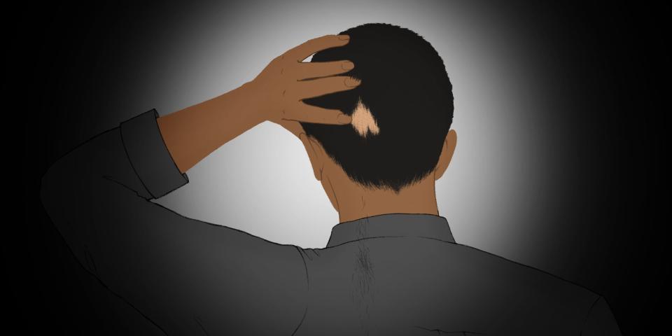 An illustration of the back of a man's head. He has dark hair and is reaching up to a bald spot in the back of his hair.