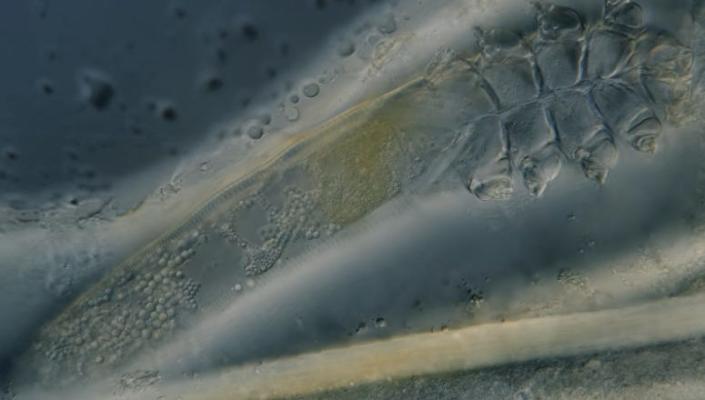 Imagen microscópica del cuerpo completo de un ácaro de la cara, incluida la mitad superior con patas y la mitad inferior larga donde digiere el aceite de la piel.