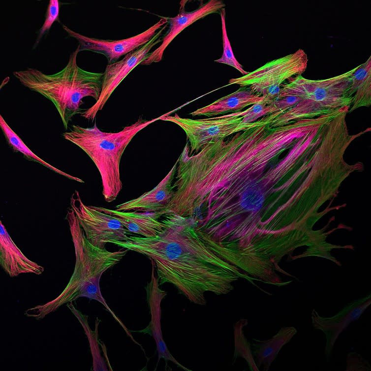 <span class="caption">Mesenchymal stem cells can differentiate into bone, cartilage, muscle and fat cells.</span> <span class="attribution"><a class="link " href="https://www.flickr.com/photos/vculibraries/14061066882/in/photolist-qGEJfq-mhHsTB-pVBh1u-iqknYh-5iqX7N-PeAd2U-gMYr3E-bpDJgr-uGnQbu-useKWk-iBn4N-o3dKej-tMFzaC-usfiDi-tMFzaY-zoYcLE-uJWuok-us6JdA-nHw52Y-cBKU95-uGnuZ3-uJWaN4-uJemSb-yC7hPG-uJW2jF-uJFP6z-uJGoe8-QKf9f8-zDhEww-7BX3K-Qt9FZG-uTxC4r-rkBP7s-GPvStS-nqwDiC-w6RcCA-RobMAi-x3Q29D-zz9L1c-yC7yZC-zhxmzU-xcYXLw-vUs4bu-vUs4c1-sfSdYe-sfS8eP-rYsC6D-paFGmt-pDKwE7-7Y9brF" rel="nofollow noopener" target="_blank" data-ylk="slk:VCU Libraries/Flikr;elm:context_link;itc:0;sec:content-canvas">VCU Libraries/Flikr</a>, <a class="link " href="http://creativecommons.org/licenses/by-sa/4.0/" rel="nofollow noopener" target="_blank" data-ylk="slk:CC BY-SA;elm:context_link;itc:0;sec:content-canvas">CC BY-SA</a></span>