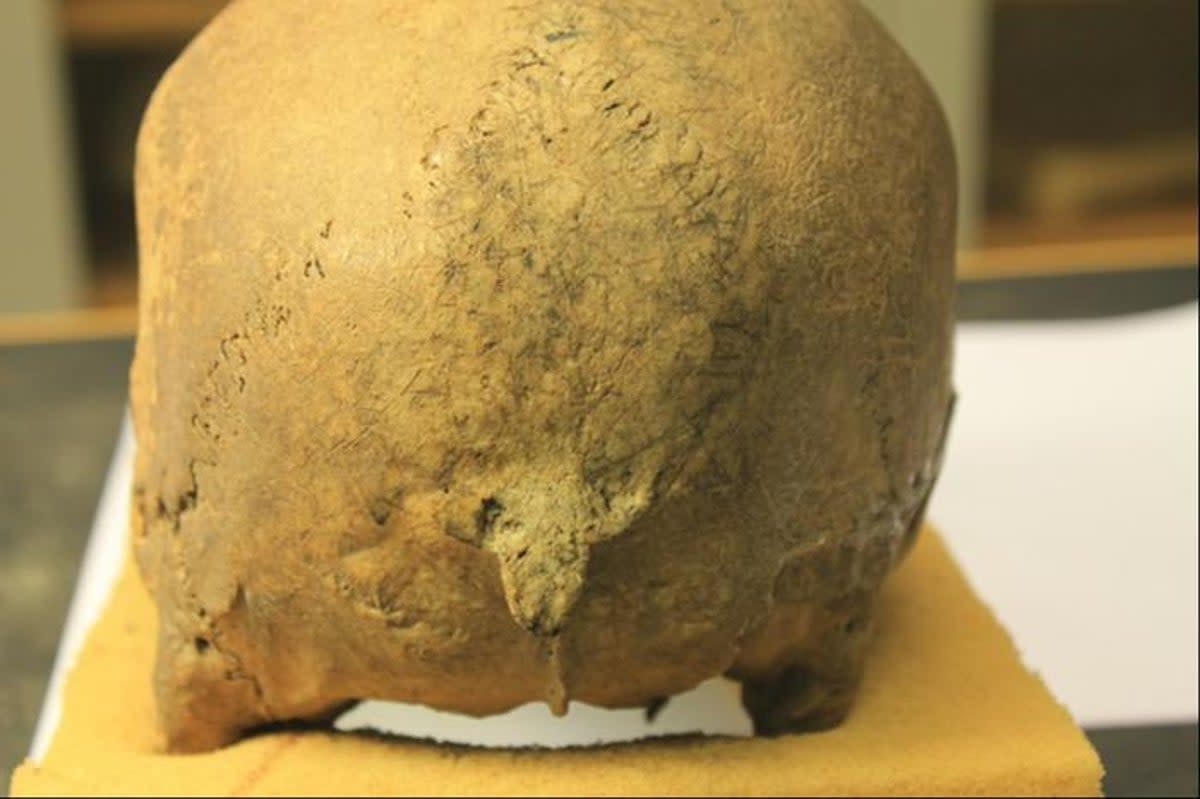 Damage seen on remodelled Viking skull bone (Lisa Mariann Strand)