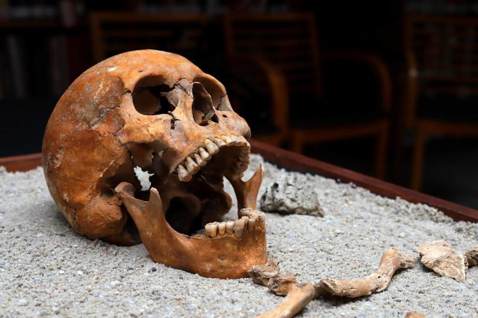 Physician’s skull on display