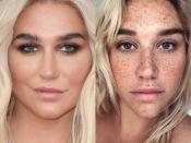 kesha freckles twitter pic