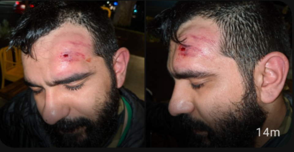 National Lawyers Guild Sacramento board member Danny Garza was leaning against a wall on the sidewalk when he was struck in the forehead with a bullet fired by a Sacramento Police officer from about 25 feet away, according to the group, on May 30, 2020.