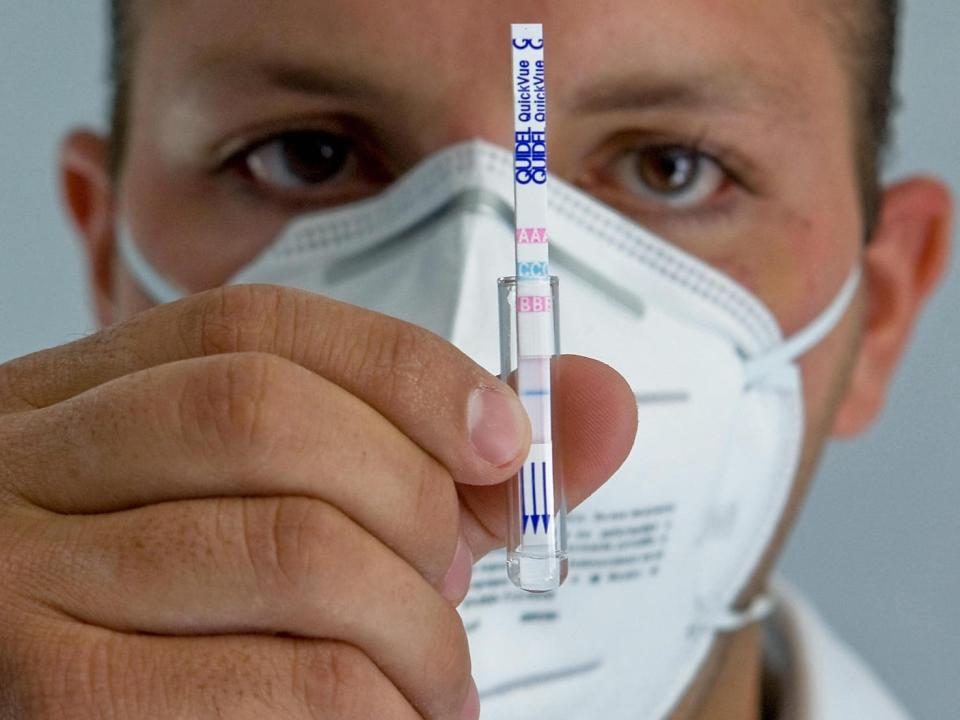 Doctor Fabian Villasenor shows a mucus sample and the reactive strip employed to detect the influenza A(H1N1) (swine flu) virus, taken from one-year-old child Ulises Gabriel Sanchez (out of frame), in Mexico city, on April 30, 2009.