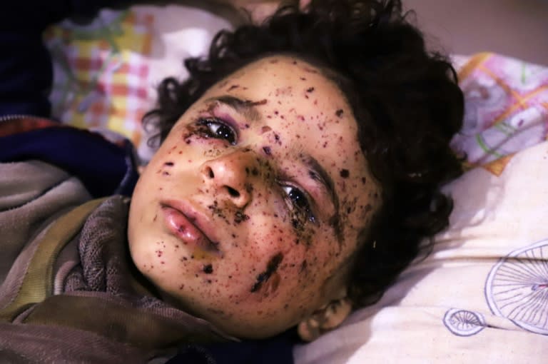 Ten-year-old Omar was injured in an air strike that killed several members of his family in Syria's rebel-held enclave of Eastern Ghouta