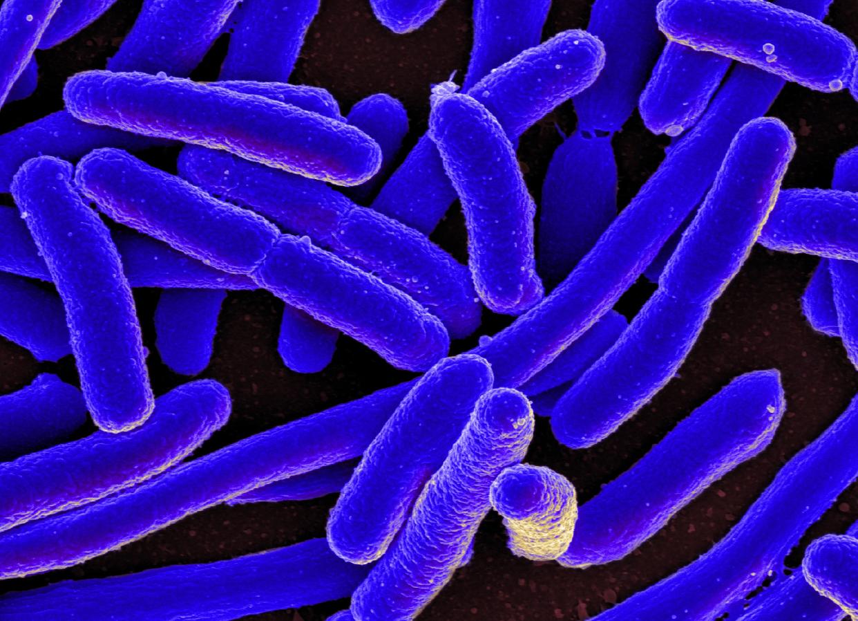 <span class="caption">Bactéries Escherichia coli colorisées observées au microscope.</span> <span class="attribution"><a class="link " href="https://www.flickr.com/photos/niaid/16578744517/in/photolist-rg1p9H-2jpFs22-2eeZCPn-2hqesQh-6LB7Xf-nTpfYq-7U6Fh7-7U6F2U-5sKPGN-5sFrKe-uc9VJc-ucjrdv-u9PsXY-tf8iTL-axZxvE-2jcj8pN-2hYHYNk-Dkibj3-2jtmK5J-2iisE51-dZT5pw-Cp6Wii-pfavNe-2k9dNHT-29ZWzjP-2hqmXos-c9v3mj-qxzuR4-rdpprZ-252JBgt-ubLpL7-dVUdVS-61KxGU-gK5Hvo-2gyPi8d-gLQmac-dVNChz-dVUdRq-dVUdTJ-7RbNW9-nD5LLF-nmAfP3-6QfpSH-9Pryd2-2jQvwsX-CiTx8e-dVNCzK-Uyq2Kc-9Puozo-npZ5dg/" rel="nofollow noopener" target="_blank" data-ylk="slk:NIAID / Flickr;elm:context_link;itc:0;sec:content-canvas">NIAID / Flickr</a>, <a class="link " href="http://creativecommons.org/licenses/by-sa/4.0/" rel="nofollow noopener" target="_blank" data-ylk="slk:CC BY-SA;elm:context_link;itc:0;sec:content-canvas">CC BY-SA</a></span>