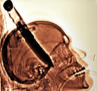 An X-ray of Michael Hill, of Jacksonville, Fla., with an eight inch knife sticking out of his skull is on display during the grand opening celebration of Ripley's Believe It Or Not Odditorium Thursday, June 21, 2007 in New York's Times Square. Ripley's Times Square site will house the ultimate in the odd and bizarre including 24 shrunken heads, a 3,197 lb meteorite and a section of the Berlin Wall. (AP Photo/ Ripley's Believe It Or Not)