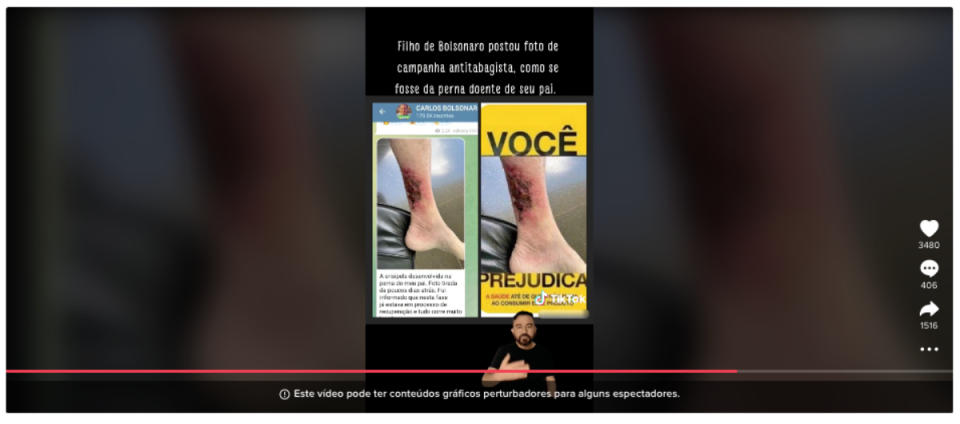 Screenshot of a post claiming that the image of Bolsonaro's leg injury, caused by erysipelas, is actually from an anti-smoking campaign (Photo: TikTok/Reprodução )