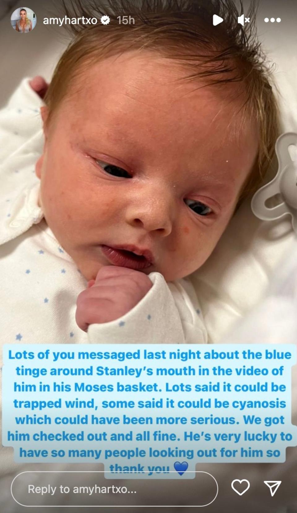 Hart told fans Stanley is “fine” after some suspected he could have cyanosis (Amy Hart/Instagram)